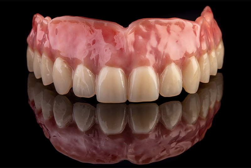 Denture example model