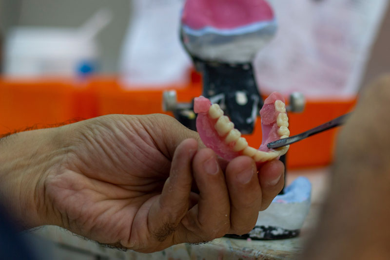 a dental professional working on a final prosthesis for full mouth dental implants.