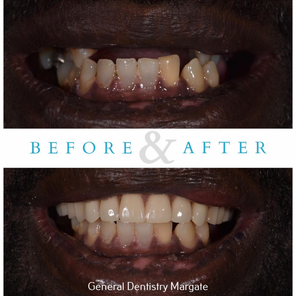 Exploring Homegrown Airboat Tours in Margate, FL Smile Design Dental